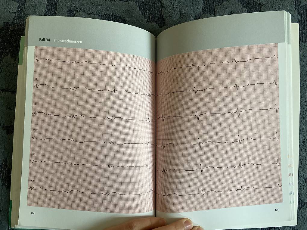 Die 50 Wichtigsten Fälle Innere Medizin Gebraucht www.tutti.ch